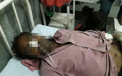 印度男子腹中有个酒瓶 竟是喝酒时吞下去的