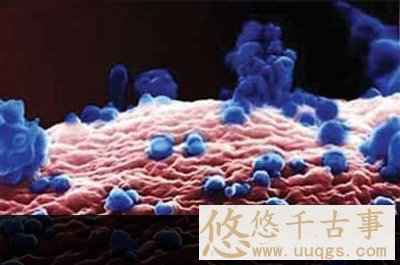 h1n1
