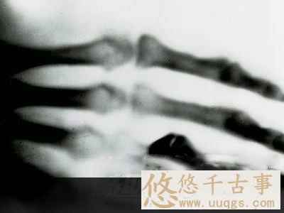 X射线技术