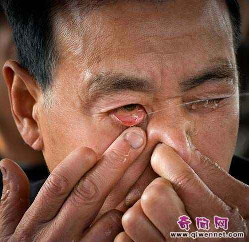 河南63岁老人绝活：鼻子吸水后眼睛喷水灭蜡烛_故事吧
