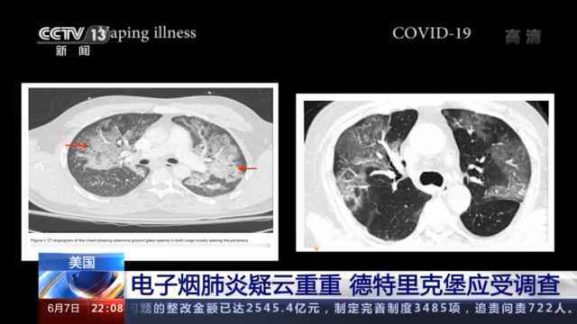 “德特里克堡”！ 你究竟干了什么？